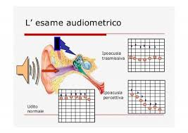 Esame Audiometrico per l'Udito