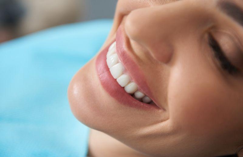 Denti fissi senza impianto