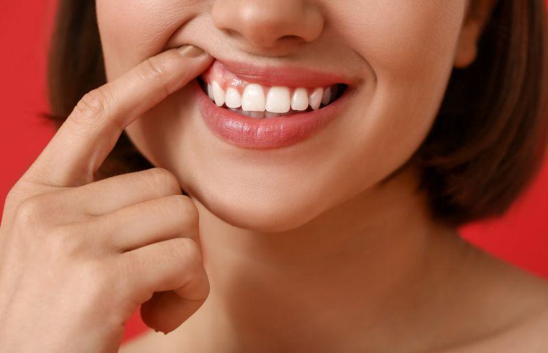 Capsula dente