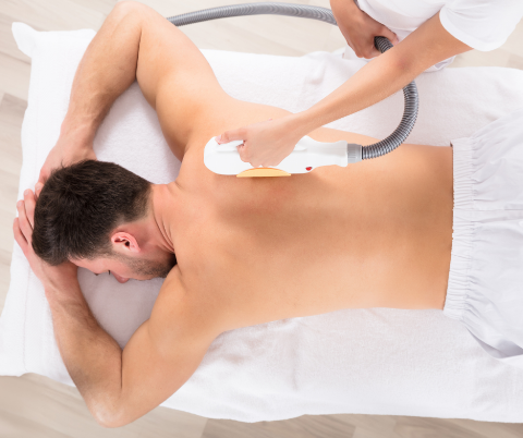Epilazione Laser a Diodo