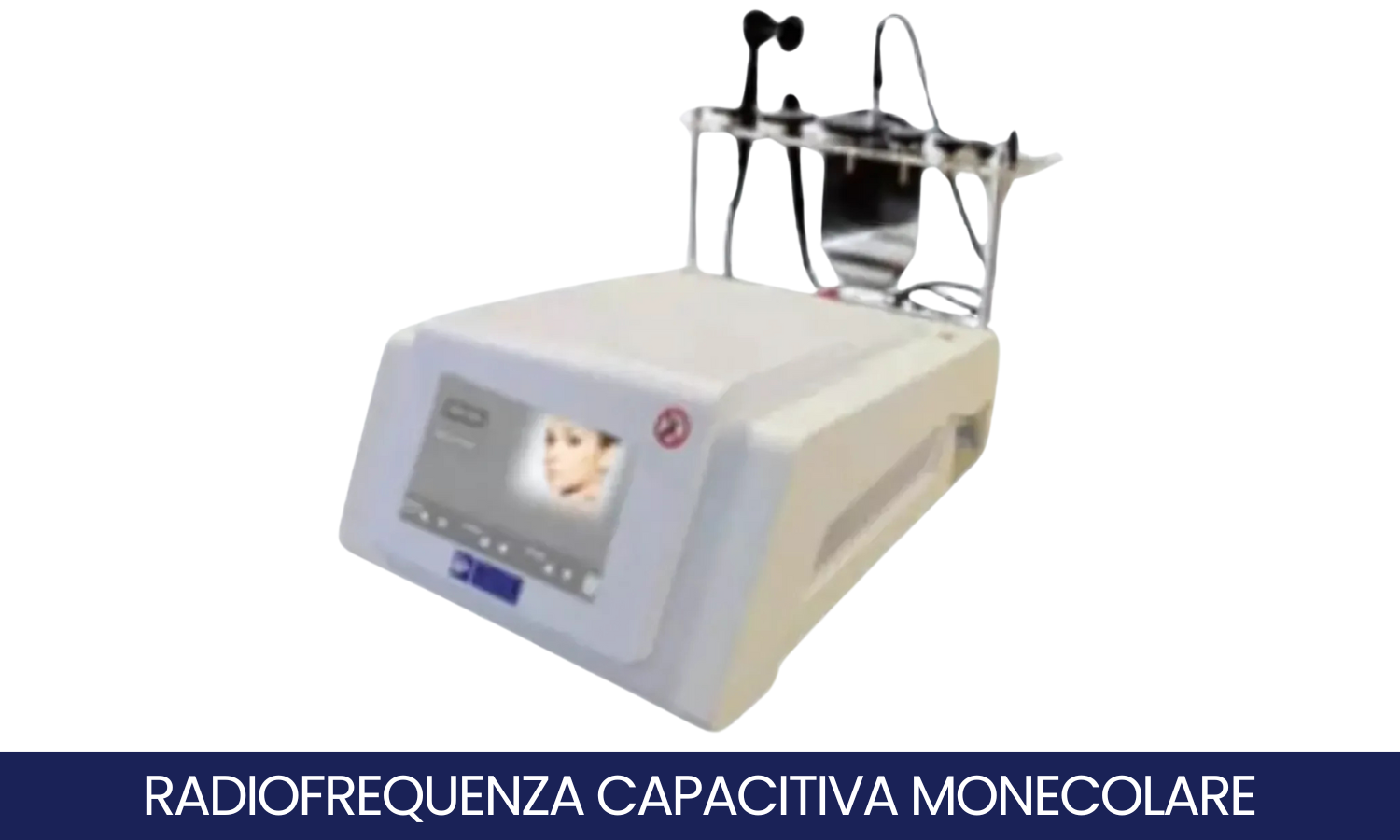 Radiofrequenza
