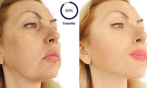 Apparecchiatura Estetica Clinik Derm Criohot 2.0