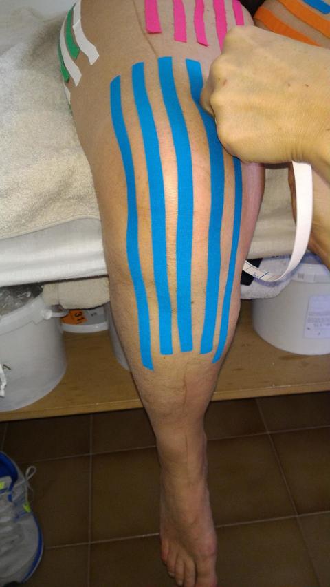 DERMOTAPING
