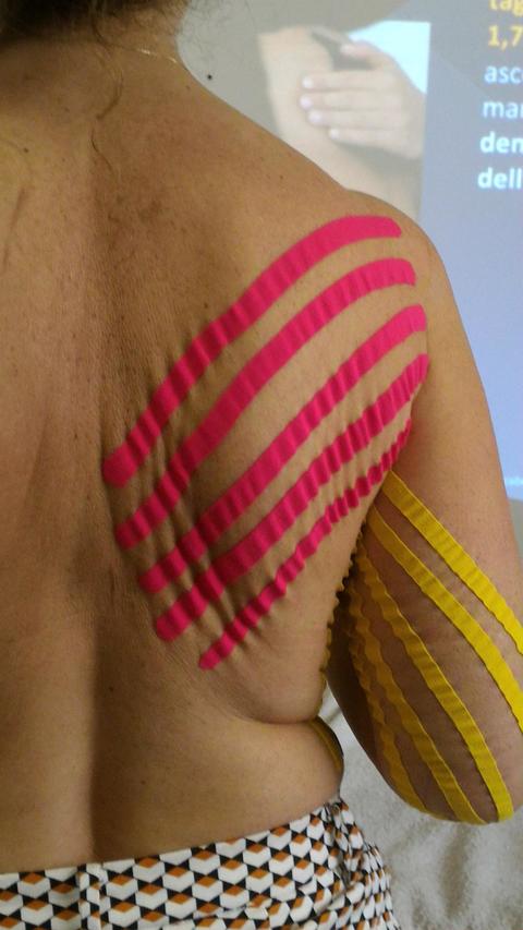 DERMOTAPING