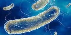 Analisi della Legionella