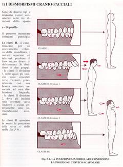 Le ripercussioni delle malocclusioni sulla postura